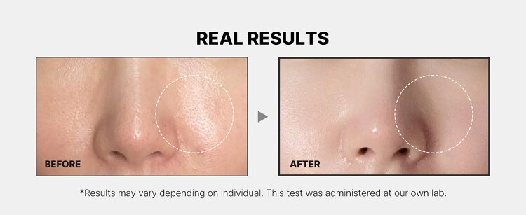 Medicube Zero Pore Pad Effect.jpg Medicube Zero Pore Pad Effect.jpg